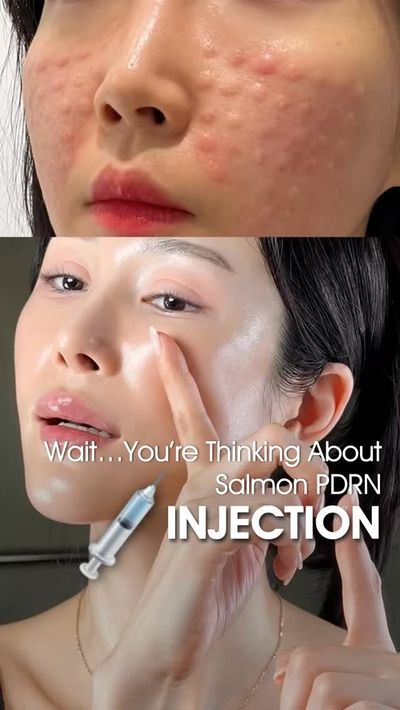 Wait... you’re thinking about salmon injections? 👀

Before you go that far, try upgrading your nigh