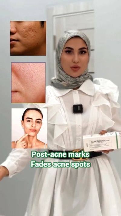 Say goodbye to post-acne marks in just 15 minutes. â±âœ¨
Say hello to calm, repaired, glassy skin w