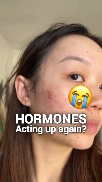 âœ¨ POV: Finally found the cure for hormonal acne & skin mood swings.

When hormones flip, your skin