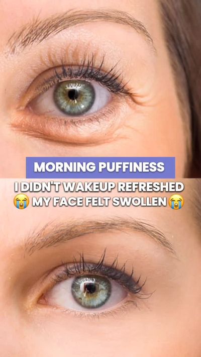 ðŸ¤¯ Jawline gone in the morning?
Thatâ€™s puffiness talking â€” not fat.

De-puff the smart way wit
