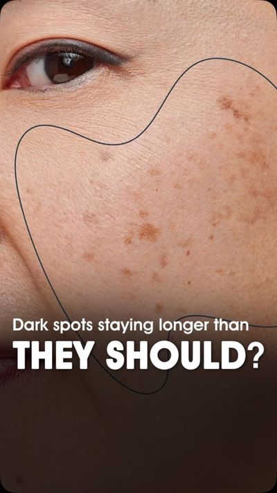 Your skincare might not be the problemâ€”how itâ€™s delivered could be.

Meet the AALOK SkinMax Radi