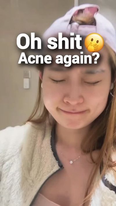 Whiteheads keep popping up in the same spot? ðŸ˜£
My whitehead-removal lifesaver â€” Axcne Booster C