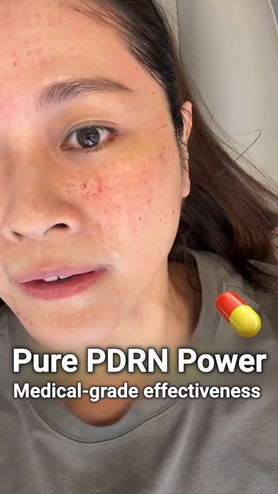 99.99% pure, medical-grade PDRN (1000ppm) thatâ€™s trusted in aesthetic treatments for regeneration 