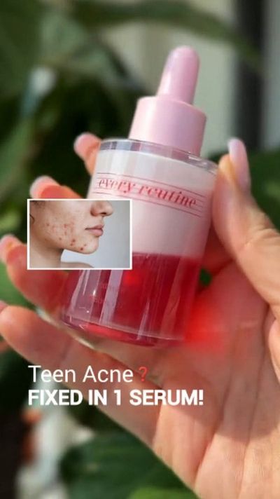 âœ¨ Teen acne doesnâ€™t have to follow you into your glow-up âœ¨
Hormones may mess with your skin, b