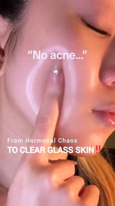 âœ¨ Hormonal chaos? Not anymore. Meet your shortcut to glass skin ðŸ’§ðŸ’«

#EveryRoutine #EstroAmpo