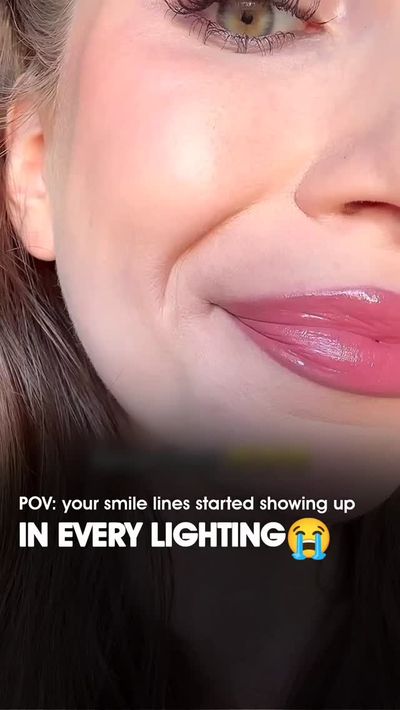 â€œPOV: your smile lines started showing up in every lightingâ€¦ ðŸ˜­ðŸ’”â€
At that point, I knew m