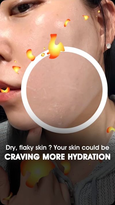 Your skin deserves more than just another skincare step. ðŸ’™

Meet the Aalok SkinMax Hydrating & So