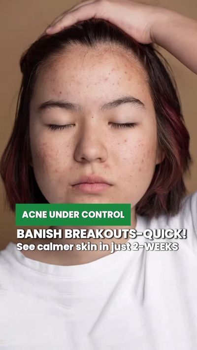 When your skin barrier says â€œenough,â€ this is the cream itâ€™s waiting for ðŸ’â€â™€ï¸

Daily 