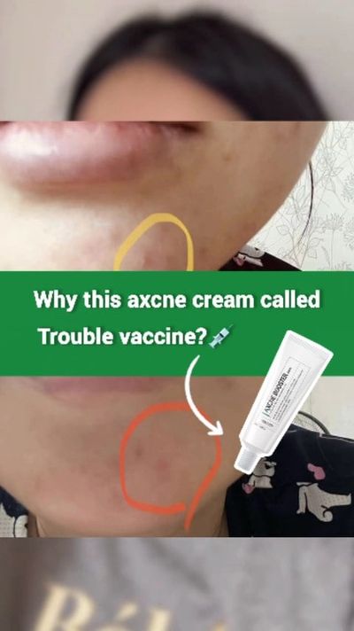 Your skin has been through enough with this unpredictable humid-dry weather.

Thatâ€™s why the â€œsk