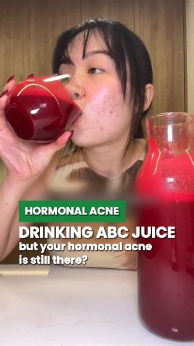 ðŸ‘€ Still blaming juice cleanses, moon cycles, or that "one cheat meal" for your stubborn hormonal 