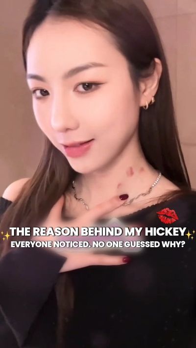 ðŸ˜Â Everyone spotted my "hickey". But NO ONE guessed the real reason!ðŸ‘€

ðŸ¥°Turns out, it's not