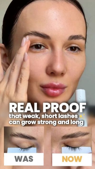 ðŸ†Koreaâ€™s No.1 Eyelash Nutrient
Be honestâ€¦ Are your lashes thin? short? breaking? falling? ðŸ‘