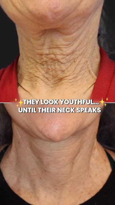 ðŸ˜Your skincare routine might be expensive and flawless. But if your neck gives away the years!

I