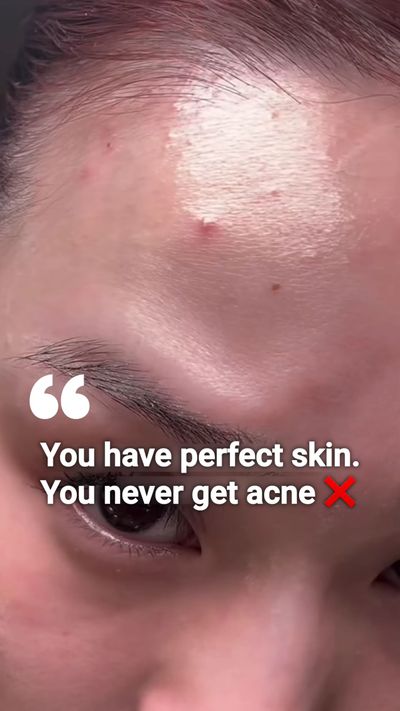 Hereâ€™s AXCNE Booster Cream â€” your skinâ€™s new acne-fighting BFF ðŸ’š

Smooth texture, zero stic